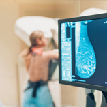 ماموگرافی در مطب دکتر فریبا خودکار